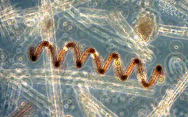 Anabaena sp.