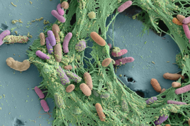 Die im Wasser lebenden Legionellen-Bakterien können die Infektionskrankheit Legionellose verursachen. Die Legionärskrankheit kann durch Tröpfcheninfektion zu einer Lungenentzündung führen. (Elektronenmikroskopaufnahme: ZMB (UZH) & Frederik Hammes)