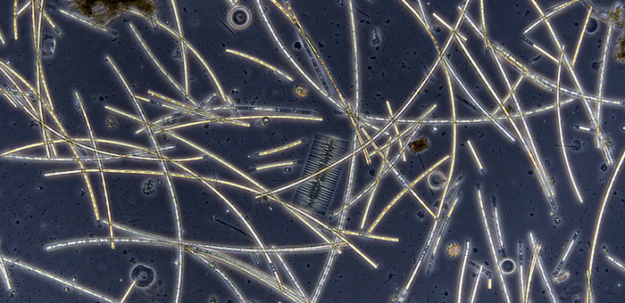 Warming of lakes reduces interactions in plankton networks – in the picture a microscope image is shown of a plankton community from Lake Greifen (Photo: Marta Reyes, Eawag).