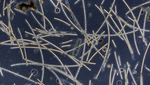 Le réchauffement des lacs réduit les interactions dans les réseaux planctoniques: la photo prise au microscope montre une population planctonique du lac de Greifen (Photo: Marta Reyes, Eawag).