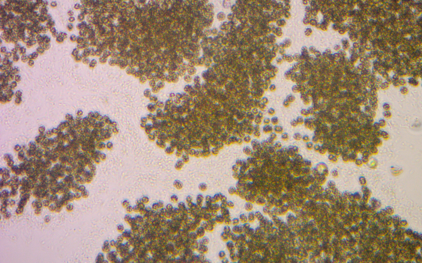 Microcystis unter dem Mikroskop. Das Foto zeigt im Original in der Breite rund einen halben Millimeter (Eawag).