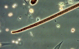 Planktothrix tenuis