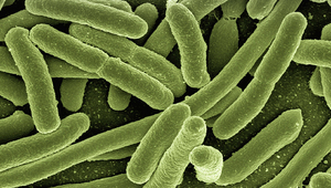 Escherichia coli. (photo: Pixabay)