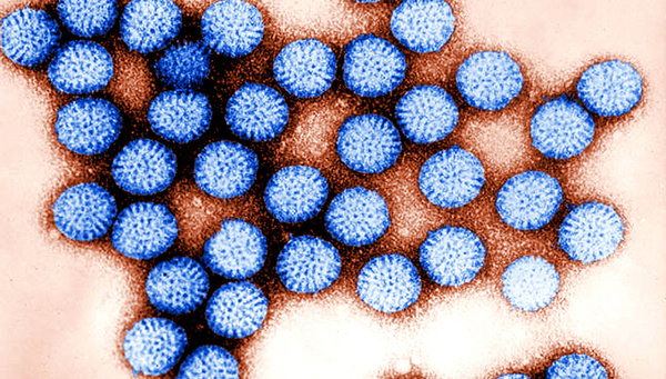 Kleiner als ein Zehntausendstel Millimeter: Rotaviren gehören zu den häufigsten Durchfallerregern in Ländern ohne sichere Wasserversorgungen. (Illustration: pixnio.com) 