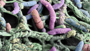 Une image au microscope électronique des communautés bactériennes dans un tube de douche. (Photo : Frederik Hammes et ZMB, UZH)