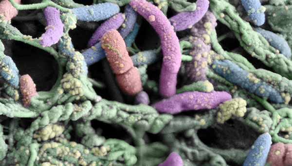 Electron micrograph of bacterial communities in a shower hose. (Photo: Frederik Hammes and ZMB, UZH)