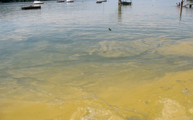 au centre et à droite: Microcystis aeruginosa, lac de Greifen (centre : Eawag, Francesco Pomati ; droite : Kantonales Labor ZH, Rene Schittli)