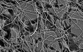 Electron microscopy image of the surface of a PBS film following incubation in a soil for six weeks: The surface of the PBS shows clear sign of degradation by colonising fungal hyphae and bacteria. (Photo: Michael Zumstein)