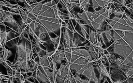 Cliché de microscopie électronique de la surface d’un film PBS après six semaines d’incubation dans le sol: la surface du PBS est déjà sensiblement dégradée par les champignons et les bactéries colonisateurs. (Photo: Michael Zumstein)