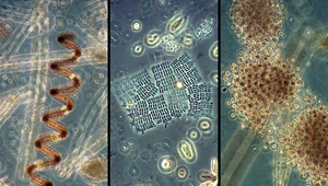 Les cyanobactéries au microscope: Anabaena sp., Merismopedium sp, Microcystis sp. (Photo: Eawag)
