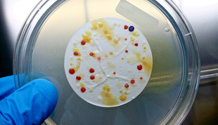 Colonies de bactéries résistantes se développant sur un milieu de culture contenant des antibiotiques.  (Photo : Helmut Bürgmann, Eawag)