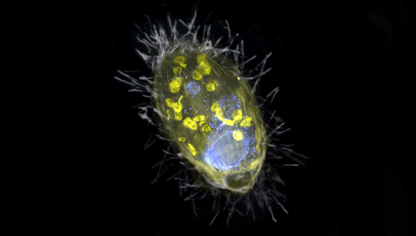 Représentation imagée de l’endosymbiote ‚Candidatus Azoamicus ciliaticola‘ et de son hôte, le cilié. (©Institut Max Planck de microbiologie marine, cf. Ahmerkamp)