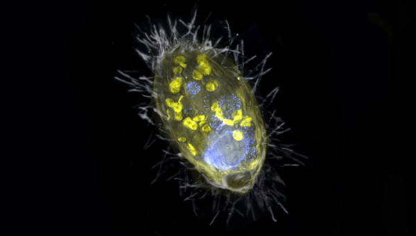 Künstlerische Darstellung des Endosymbionten ‚Candidatus Azoamicus ciliaticola‘ und seines Wirts, dem Wimperntierchen. (©Max-Planck-Institut für Marine Mikrobiologie, S. Ahmerkamp)