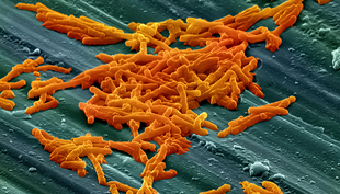 Clostridium bacteria make spores and occur frequently in intestinal flora. (Source: Annie Cavanagh https://wellcomecollection.org/works/ct6qa6fw?query=clostridium)