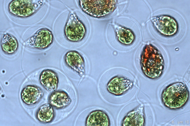 Algenzellen unter dem Mikroskop (Foto: Bettina Wagner, Eawag)