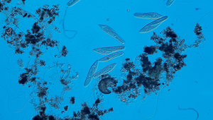 Aquatic ecosystems – such as the microbial community pictured here – are often highly diverse. (Photo: E. Mächler/F. Altermatt)