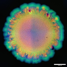 Mikroskopische Aufnahme die zeigt, wie sich Antibiotikaresistenzgene in Abhängigkeit von der räumlichen Anordnung ausbreiten. Gelben Bakterien (mit Antibiotikaresistenz) und blaue Bakterien (ohne Antibiotikaresistenz) wachsen zu räumlichen Mustern und verlieren dabei entweder die Resistenz (rot) oder erwerben sie (grün). Foto: Yinyin Ma, ETH Zürich / Eawag