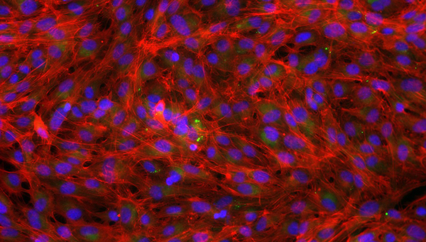 Rainbow trout gill cells were fixed and stained using molecular probes for nuclei (blue), lipid (green) and actin (red). These cells were healthy control cells unexposed to chemical stimuli. (Photo: Vivian Lu Tan, Eawag) 