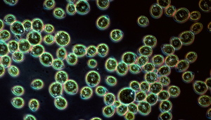 Silberionen greifen in den Zellstoffwechsel der Grünalge Chlamydomas reinhartii (Bild) ein und beeinträchtigen etwa die Fotosynthese. 