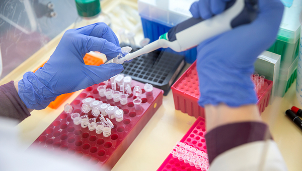 Abwasserproben werden für die PCR-Analyse vorbereitet. (Foto: Eawag, Esther Michel)