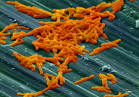 Les bactéries du genre Clostridium, qui forment des spores, sont fréquentes dans la flore intestinale. (Source: https://pictures.doccheck.com/de/photo/45110-clostridium-difficile)
