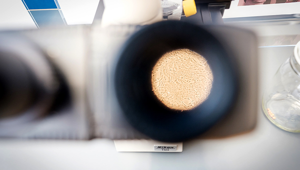 Fish cell cultures – seen here under the microscope – play a key role in developing animal-free environmental toxicity tests. (Photo: Mallaun Photography)